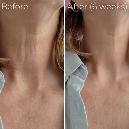 Solae™ Astaxanthin Hydrafirm