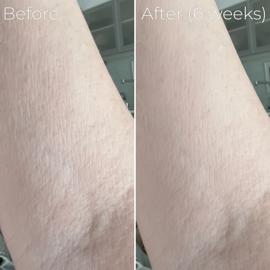 Solae™ Astaxanthin Hydrafirm