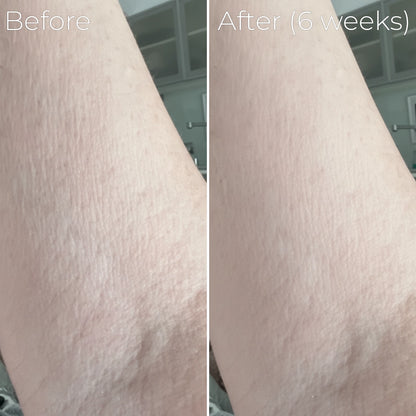 Solae™ Astaxanthin Hydrafirm